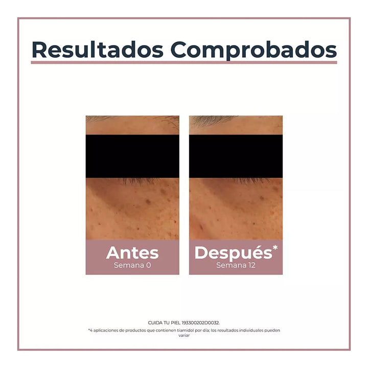 Eucerin | Antipigment Anti Ojeras