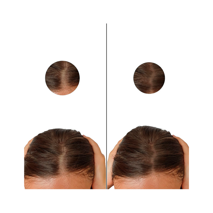 MINOXIDIL 5MG 60 CAPSULAS