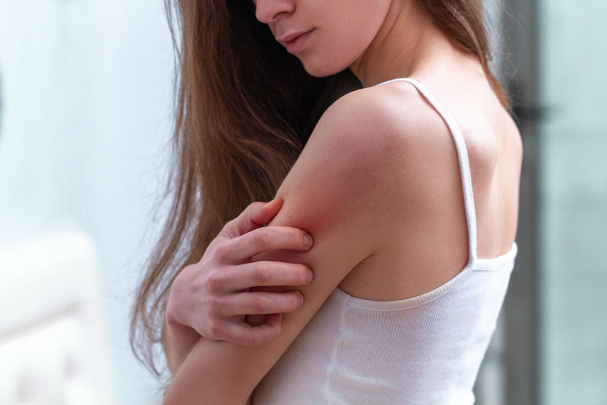 Tratamiento para alergias en la piel: DESDE LOS FAVORITOS DE FARMACIA