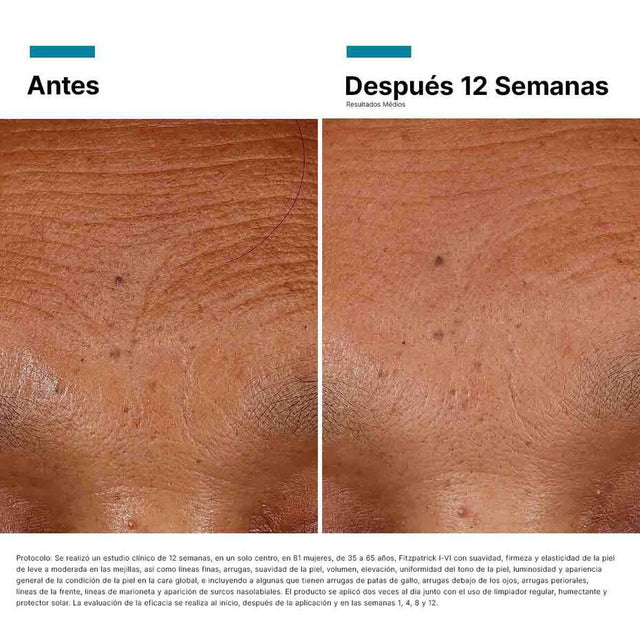 SkinCeuticals | H.A. Intensifier | Sérum Hidratante de Alta Potencia