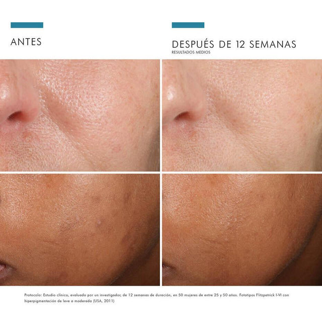 Skinceuticals Phloretin CF 30 ML