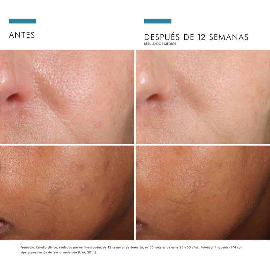 Skinceuticals | Phloretin CF 30 ML | Suero Antioxidante