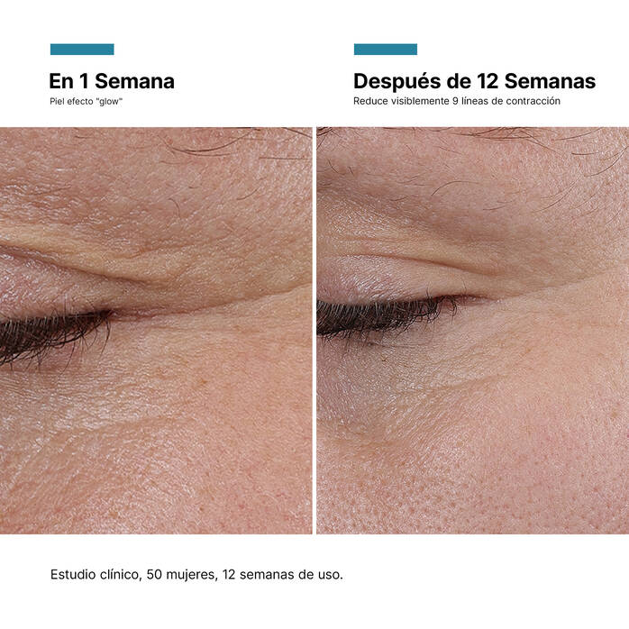 SkinCeuticals |  P-TIOX 30 ML | Sérum Facial Anti-Edad Reduce Arrugas