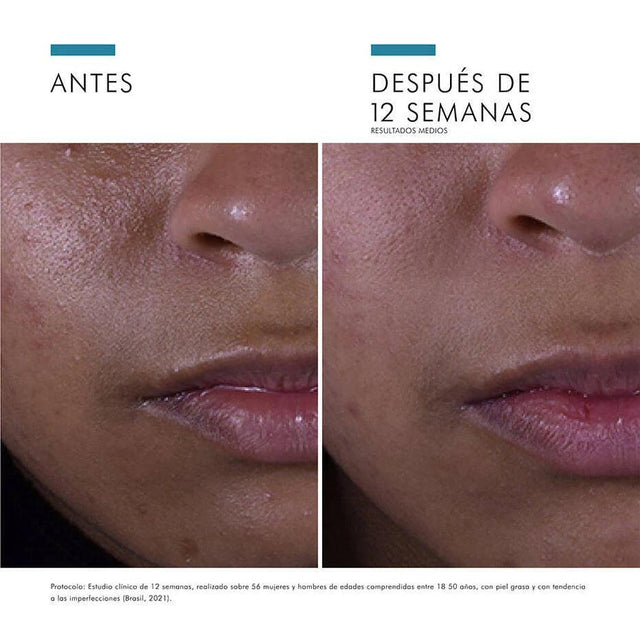 Skinceuticals | Silymarin CF de 30 ML | Sérum de Vitamina C