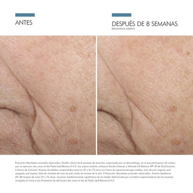 SkinCeuticals | Triple Lipid Restore 2:4:2 | Crema Antiedad