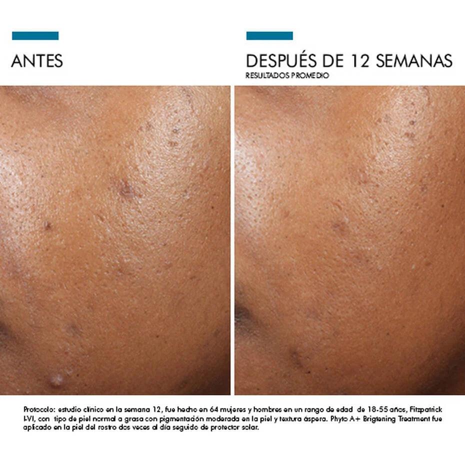 Skinceuticals | Phyto A+ Brightening Treatment 30 ml | Combate la Hiperpigmentación