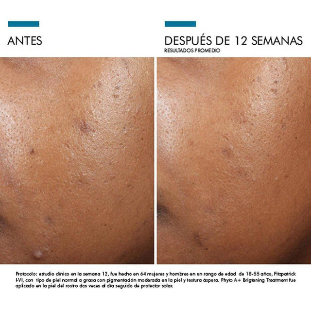 Skinceuticals | Phyto A+ Brightening Treatment 30 ml | Combate la Hiperpigmentación
