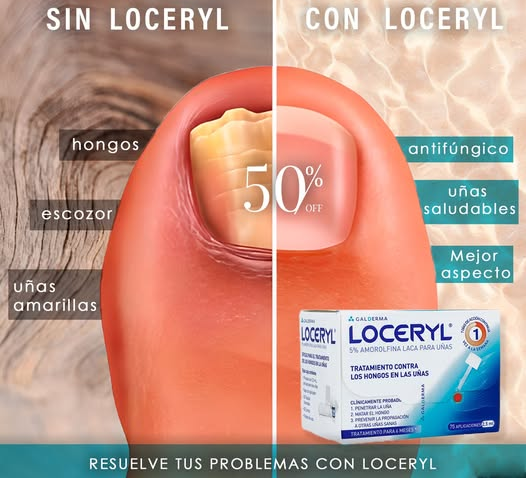 Loceryl Solución 5%, 2.5 ml.